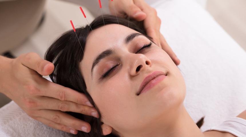 Kozmetik akupunktur nedir, nasıl yapılır, sivilce tedavisi yapılır mı? Kozmetik akupunkturun faydaları nelerdir, cildi gençleştirir mi?