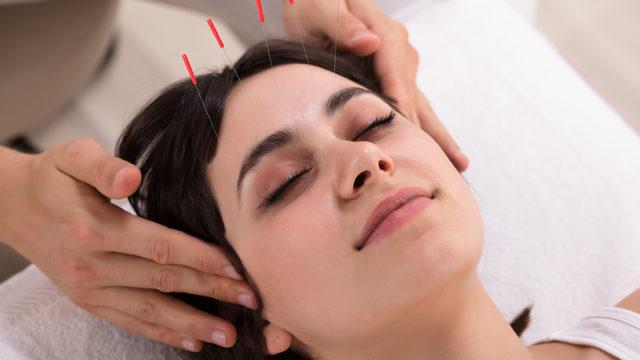 Kozmetik akupunktur nedir, nasıl yapılır, sivilce tedavisi yapılır mı? Kozmetik akupunkturun faydaları nelerdir, cildi gençleştirir mi?