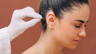 Akupunktur hangi hastalıkları tedavi eder? Akupunkturla hastalık tedavisi nasıl yapılır, alerjiye iyi gelir mi?