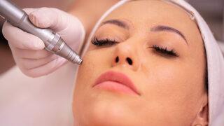 Akupunktur kalemi nedir, ne işe yarar? Akupunktur kalemi nasıl kullanılır, lazer akupunktur kalemi nedir?