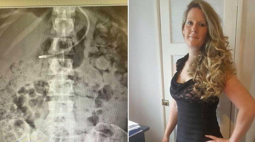 Kendi dışkısında boğuluyordu! Korku filmi gibi...