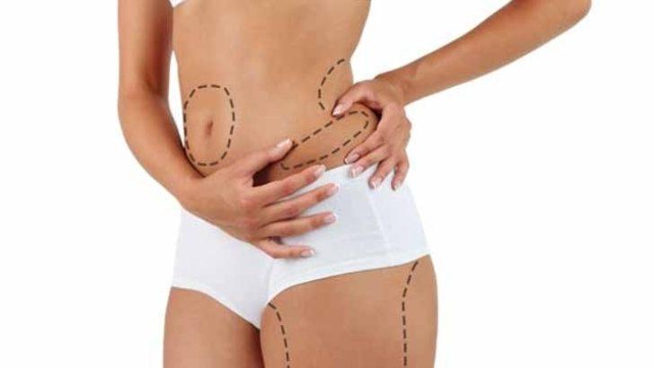 Liposuction Hakkında Tüm Merak ettikleriniz - Sağlık Haberleri