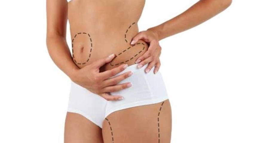 Liposuction Hakkında T&uuml;m Merak ettikleriniz