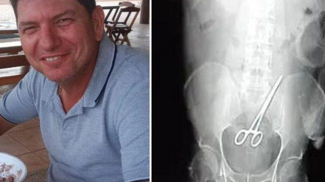 Ameliyatta içerisinde makas unutuldu! Gerçeği günler sonra...