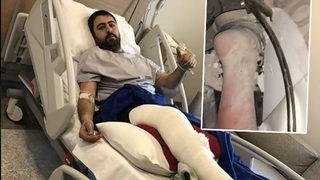 Mucize kurtuluşun hikayesi! Enkazın altından çektiği videoyla gündem yarattı... “Ölürsem mücadelem görülsün diye çektim”