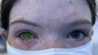 Zararsız diyerek geçmeyin! Bu böcek göz renginin değişmesine neden oluyor