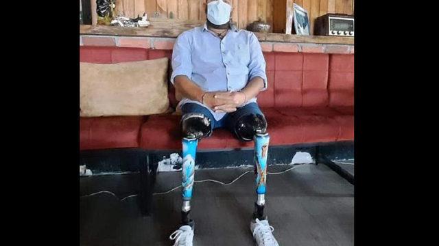 17 Ağustos'ta iki bacağını kaybetti, depremzedelere destek için bölgeye gitti! 'Ağustos sıcağında enkaz altında üşümüştüm'