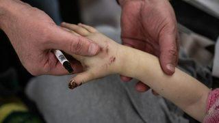 Deprem bölgesinde enfeksiyon riskine dikkat! Enfeksiyondan korunmak için alınması gereken önlemler