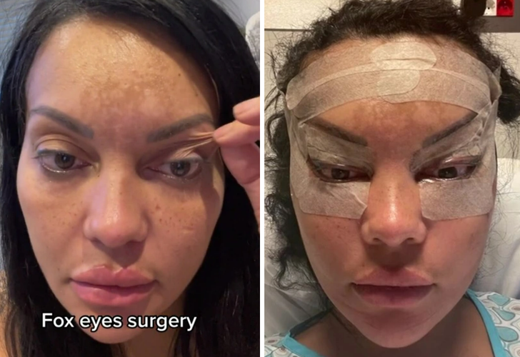 Türkiye'de olduğu ameliyat nedeniyle bir gün kör kaldı! "Sonuçlara değdi!"