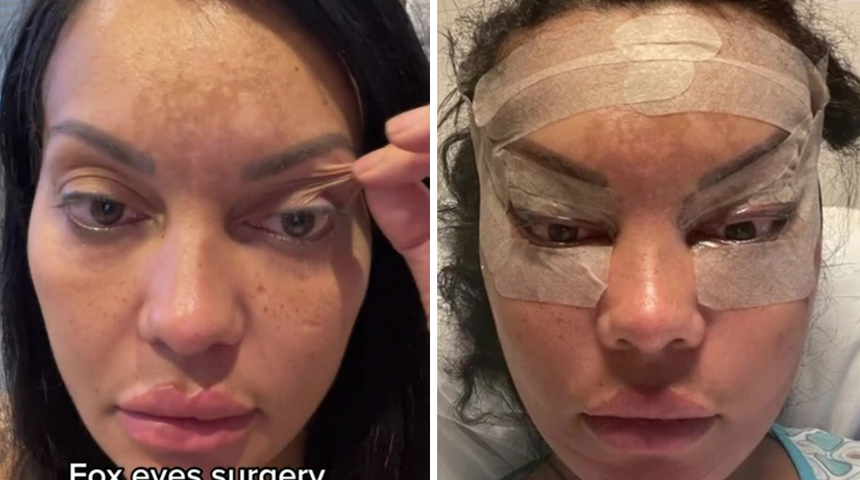 T&uuml;rkiye'de olduğu ameliyat nedeniyle bir g&uuml;n k&ouml;r kaldı! "Sonu&ccedil;lara değdi!"