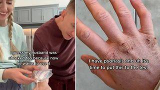 Öyle bir şeyden losyon yaptı ki... Her derde deva!