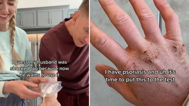 Öyle bir şeyden losyon yaptı ki... Her derde deva!