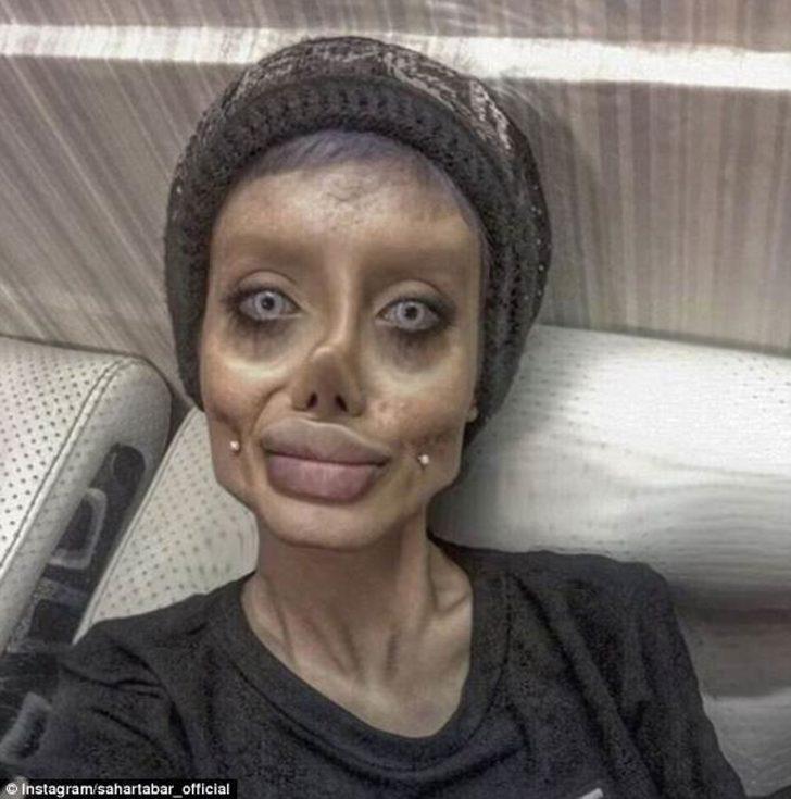 Angelina Jolie�ye benzemek isteyen kızın son hali korkunç!