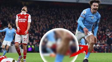 İngiltere o kareyi konuşuyor! Arsenal Manchester City maçında Jack Grealish'in adalesi gündem oldu