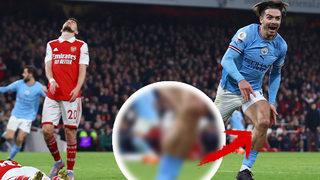 İngiltere o kareyi konuşuyor! Arsenal Manchester City maçında Jack Grealish'in adalesi gündem oldu