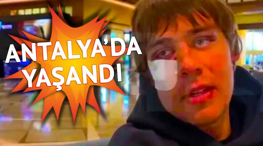 Rusya Ligi takımlarından Yaroslavl Shinnik ile Ukrayna ekibi FC Minaj takımının futbolcuları Antalya'da kaldıkları otelde birbirine girdi!