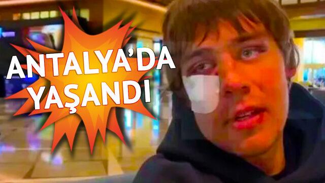 Rusya Ligi takımlarından Yaroslavl Shinnik ile Ukrayna ekibi FC Minaj takımının futbolcuları Antalya'da kaldıkları otelde birbirine girdi!