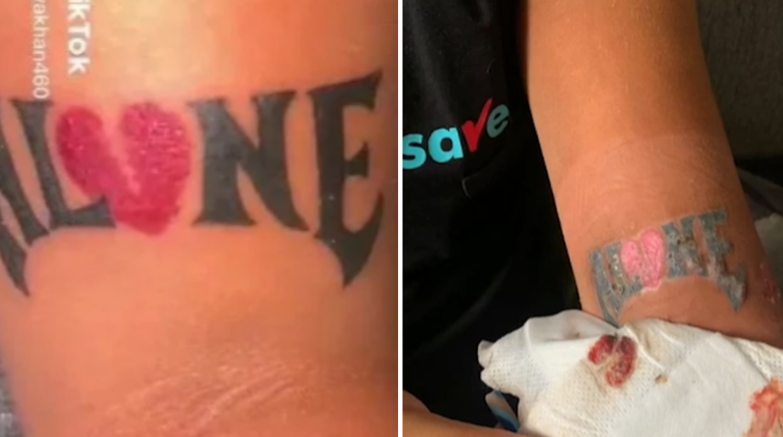 Hijyensizliğin sonu kötü bitti! Yaptırdığı dövme bir anda çürümeye başladı