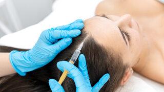 Saç mezoterapisi nedir, nasıl yapılır? Mezoterapi saç çıkarır mı, kimlere saç mezoterapisi uygulanabilir?