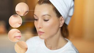 Mezoterapi faydaları nelerdir? Mezoterapi ne işe yarar, ne kadar kalıcı?