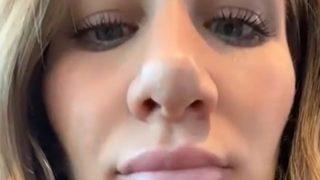 Botoks yüzünden başına gelmeyen kalmadı! Kocam benden korkuyor