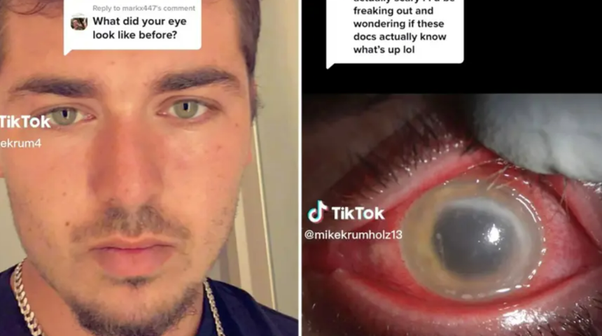 Şekerleme yapmak istedi hayatı karardı! "Et yiyen parazit yüzünden tek gözüm kör oldu"