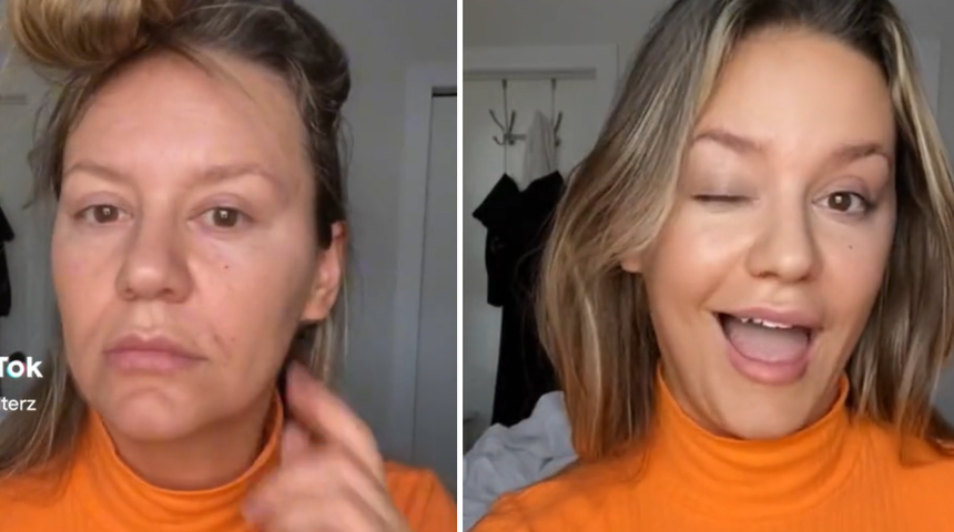 Sadece saniyeler içinde 20 yaş gençleşti! Botoks kullanmadan yaptığı ilginç gençleştirme yöntemini paylaştı