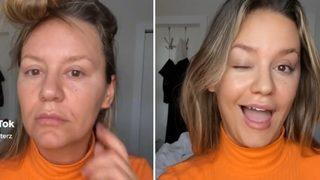 Sadece saniyeler içinde 20 yaş gençleşti! Botoks kullanmadan yaptığı ilginç gençleştirme yöntemini paylaştı