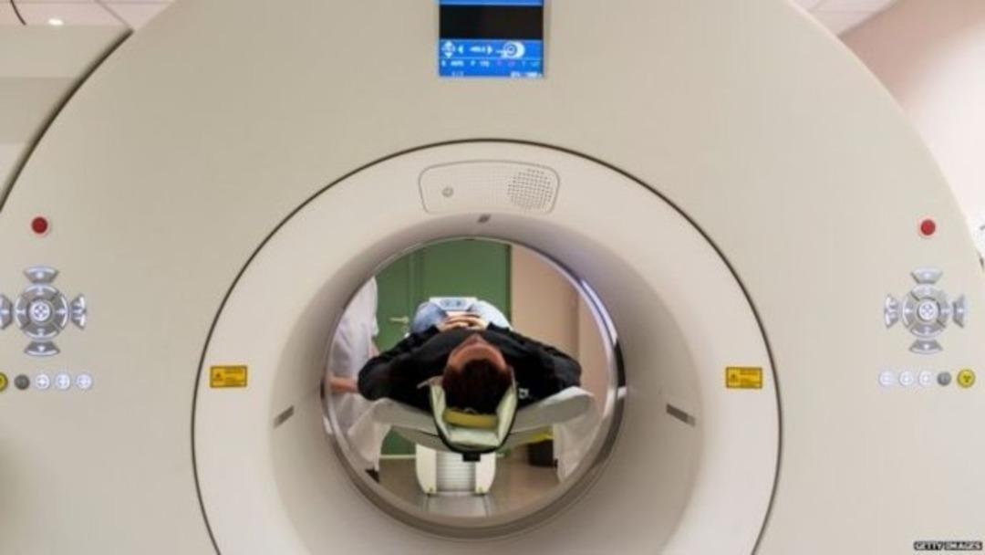 D&uuml;nyada y&uuml;z kişide g&ouml;r&uuml;len hastalık: Cotard Sendromu! O bir yaşayan &ouml;l&uuml;!