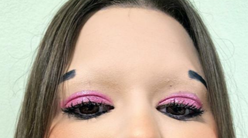 D&uuml;nyanın en b&uuml;y&uuml;k dudaklarına sahip kadını rekora koşuyor! Ameliyat parasını &ouml;demek i&ccedil;in...