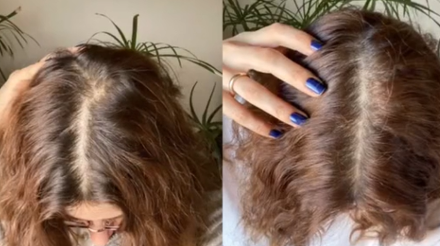 Tek malzeme ile dökülen yerlerden saç fışkırtıyor! Saç ektirme etkisi yaratıyor