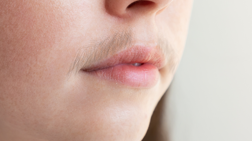 Yüzünüzdeki istenmeyen tüyleri kökten bitiriyor! Doğal yöntemle istenmeyen tüylerden kurtulmak için...