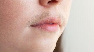 Yüzünüzdeki istenmeyen tüyleri kökten bitiriyor! Doğal yöntemle istenmeyen tüylerden kurtulmak için...