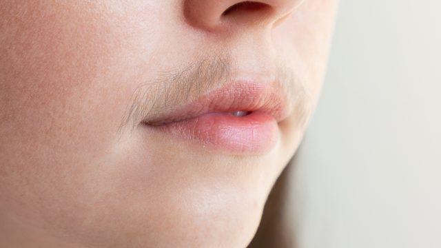 Yüzünüzdeki istenmeyen tüyleri kökten bitiriyor! Doğal yöntemle istenmeyen tüylerden kurtulmak için...