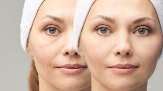 Yaşlılık izlerini yok ediyor! Botoks etkisi yaratan doğal maske tarifi