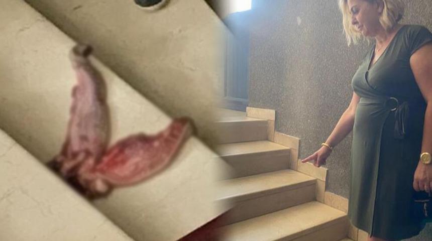 Prof. Dr. Esin Davutoğlu Şenol sosyal medyadan duyurmuştu! 'Dana dili' ile tehditte yeni gelişme