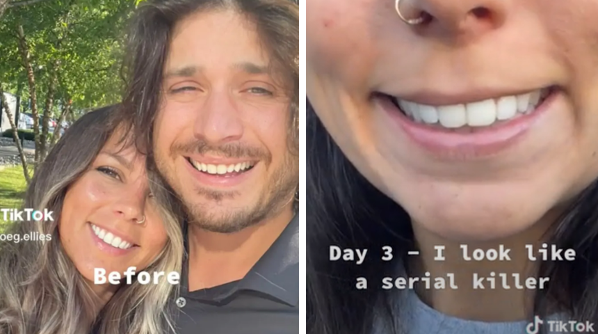 Yaptırdığı başarısız botoks başına bela oldu! "Seri katil gibi görünüyorum"