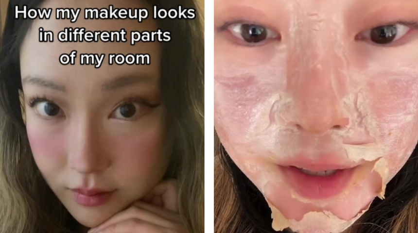 Başarısız cilt bakımının sonuçları dehşete düşürdü! Yüzü parça parça döküldü... Kimyasal peeling yaptıranları uyardı