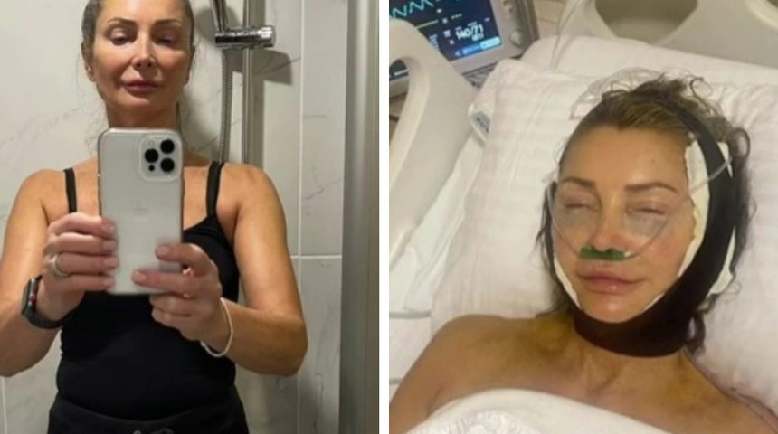 Türkiye'de olduğu ameliyatla tüm görünümünü değiştirdi! İnsanlar 20 yaş genç gözüktüğünü söylüyor