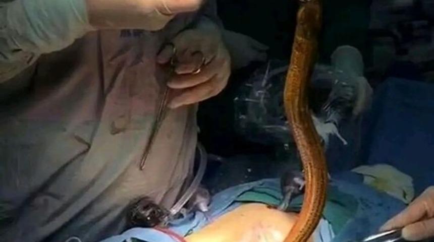 Böyle tedavi yöntemi ne görüldü ne de duyuldu! Kabızlık tedavisi için anüsüne yılan balığı soktu