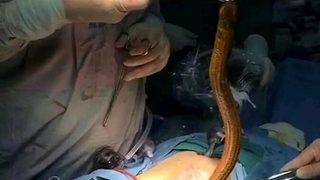 Böyle tedavi yöntemi ne görüldü ne de duyuldu! Kabızlık tedavisi için anüsüne yılan balığı soktu