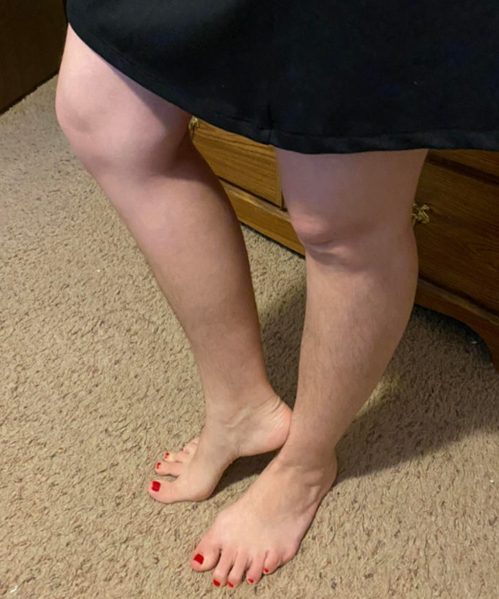 Jilet kullanmaktan vazgeçen 14 kadın vücutlarına olan sevgilerini paylaştılar! Kıllarını almayı bırakarak... G2