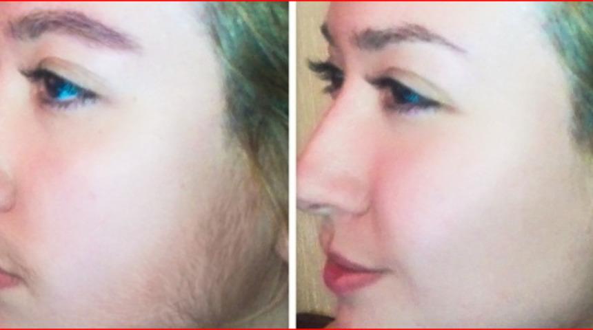 Bu maskeler yüzünüzün genç ve güzel görünmesi için!