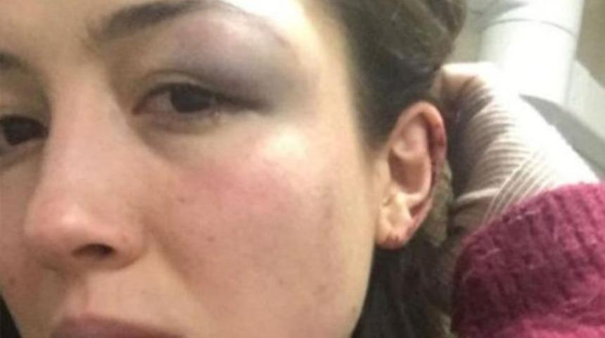 Yer: Taksim! Barda inanılmaz olay! 