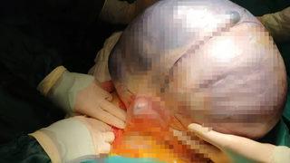 Karın ağrısı şikayetiyle hastaneye gitti, karnından çıkan kitle şaşkına çevirdi