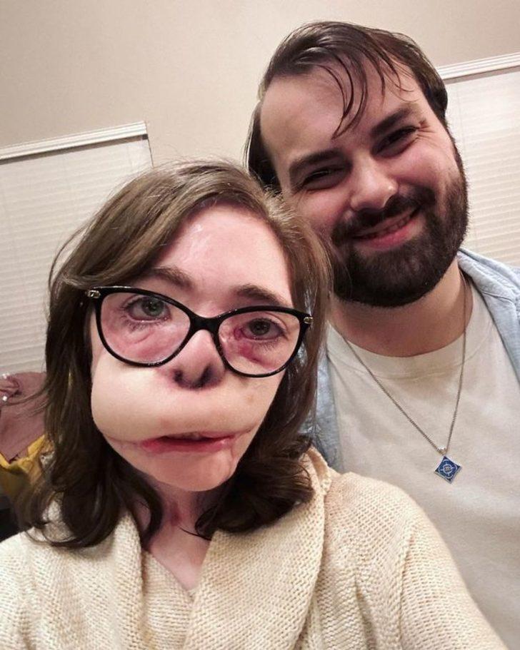 Köpekler tarafından 800 kez ısırılmıştı! 18 ameliyatın sonunda yeni halini paylaştı... Sosyal medyada gündem yarattı G1