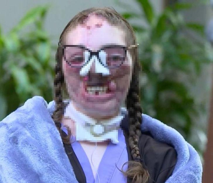 Köpekler tarafından 800 kez ısırılmıştı! 18 ameliyatın sonunda yeni halini paylaştı... Sosyal medyada gündem yarattı G2