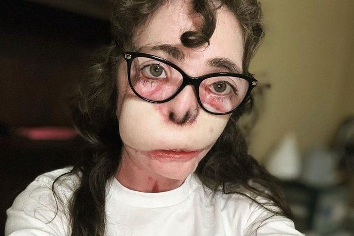 Köpekler tarafından 800 kez ısırılmıştı! 18 ameliyatın sonunda yeni halini paylaştı... Sosyal medyada gündem yarattı G3