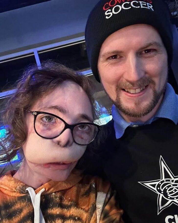 Köpekler tarafından 800 kez ısırılmıştı! 18 ameliyatın sonunda yeni halini paylaştı... Sosyal medyada gündem yarattı G4