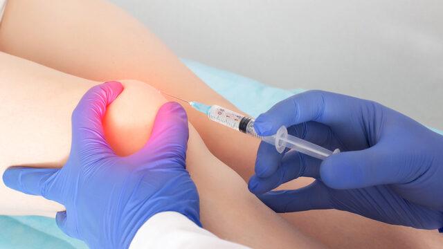 Dize ozon tedavisi nasıl yapılır, diz kireçlenmesinde ozon tedavisi nedir? Diz ağrısında ozon tedavisi işe yarar mı, ağrıyı geçirir mi?